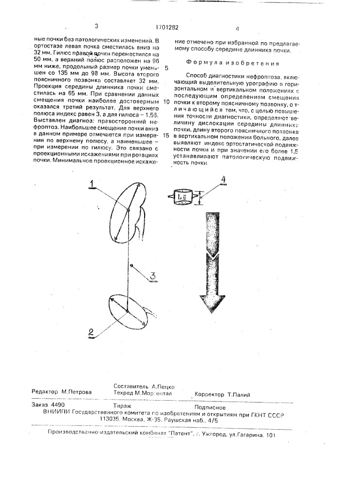 Способ диагностики нефроптоза (патент 1701282)