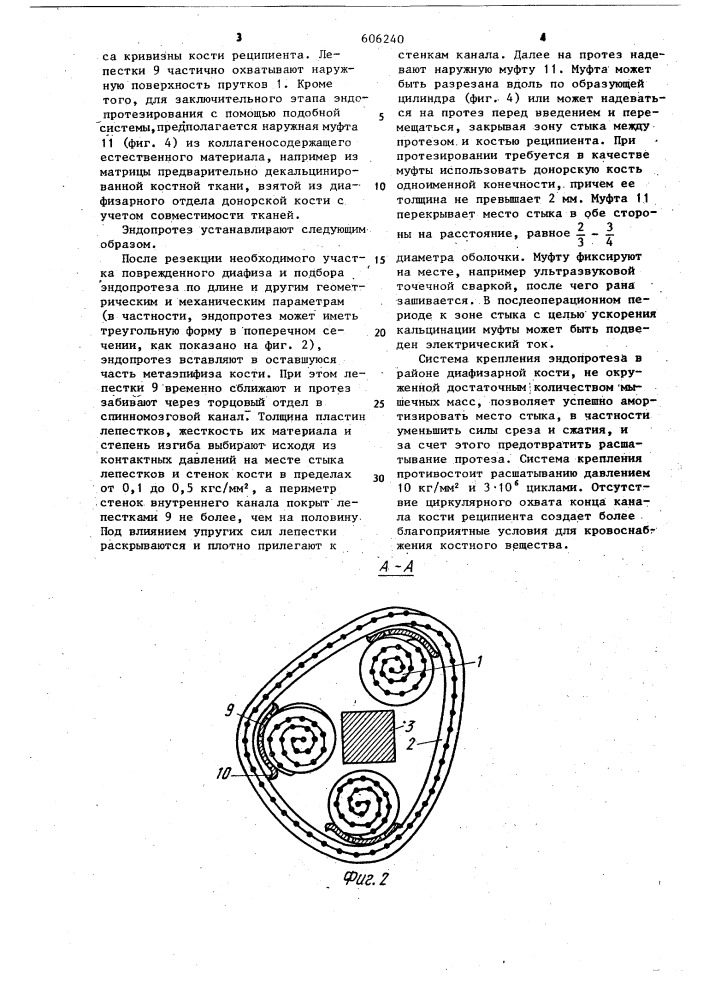 Система крепления эндопротеза диафиза кости (патент 606240)