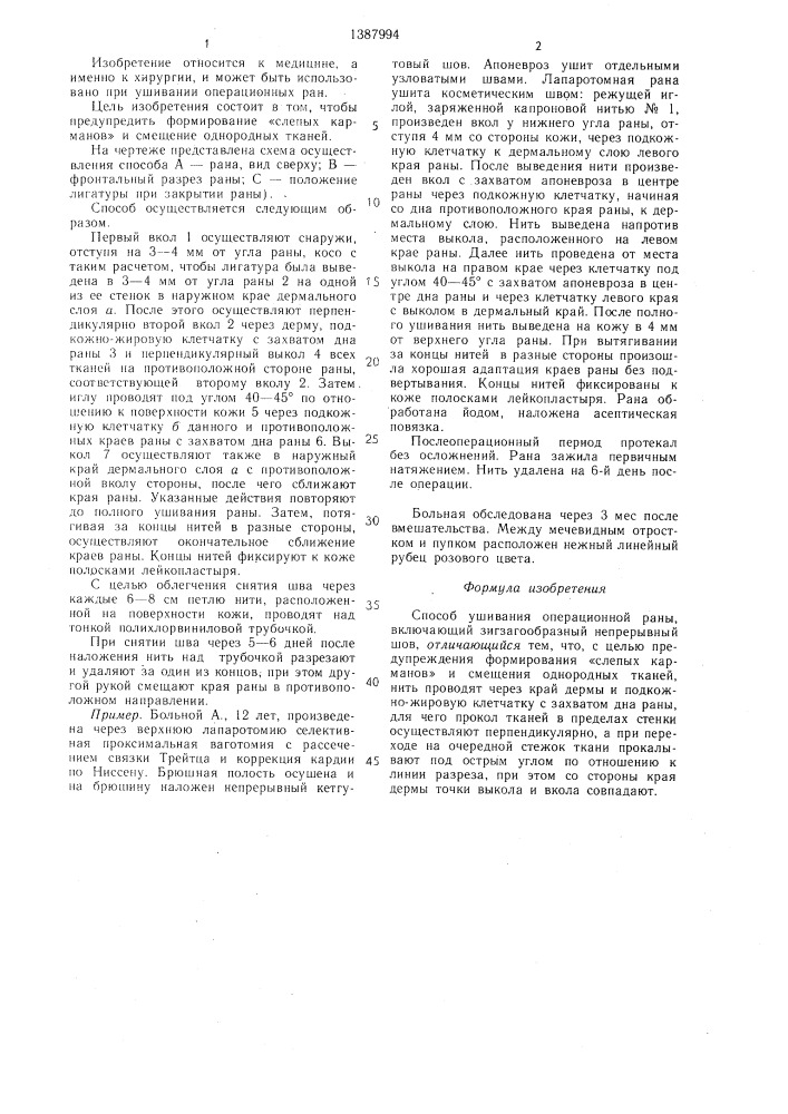 Способ ушивания операционной раны (патент 1387994)