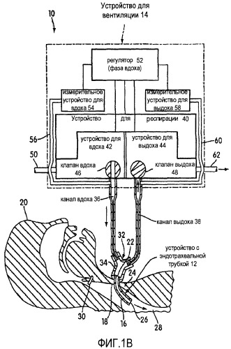 Аппарат для вентиляции и способ, позволяющий пациенту говорить с обратным клапаном трахеостомической трубки или без него (патент 2455031)