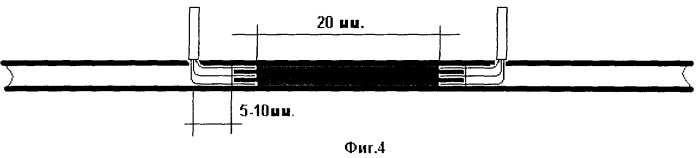 Способ лечения повреждения периферического нерва (патент 2254884)