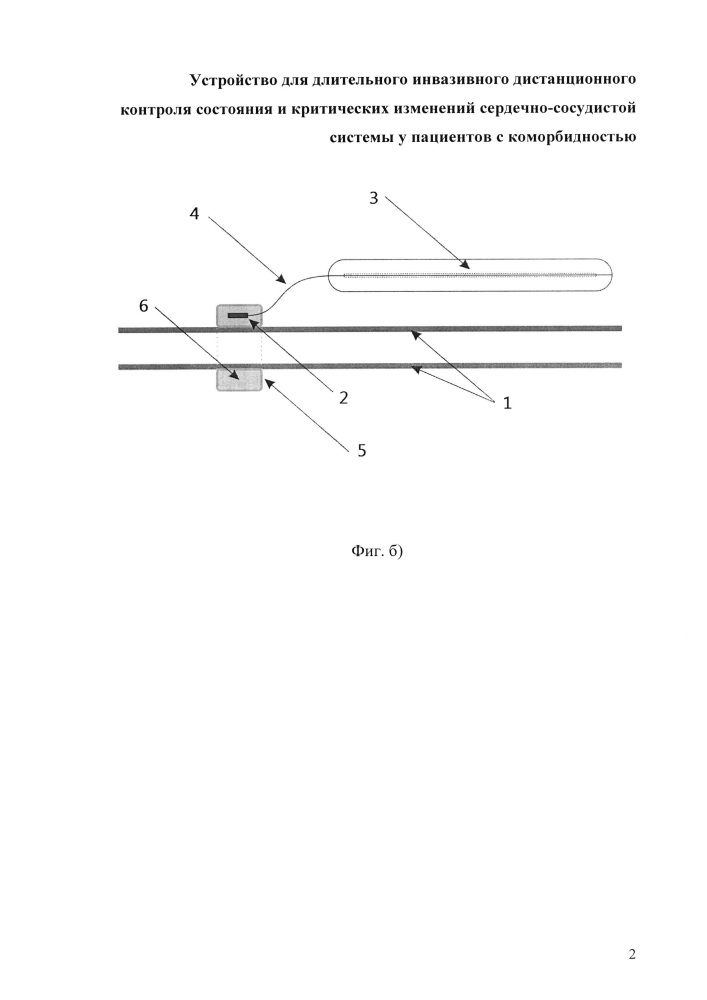 Устройство для длительного инвазивного дистанционного контроля состояния и критических изменений сердечно-сосудистой системы у пациентов с коморбидностью (патент 2613086)
