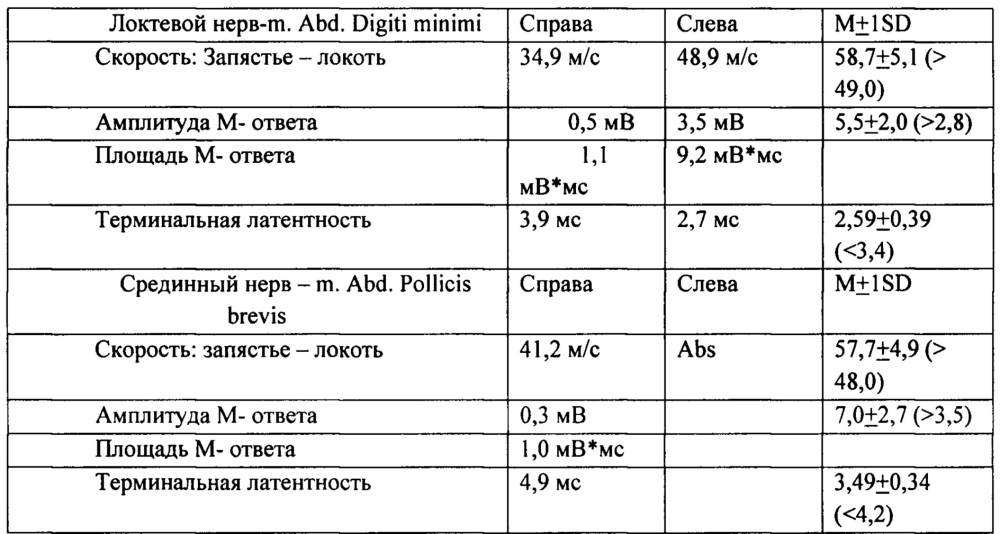 Способ дистанционной мультиволновой электромагнитной радионейроинженерии головного мозга человека (патент 2621547)