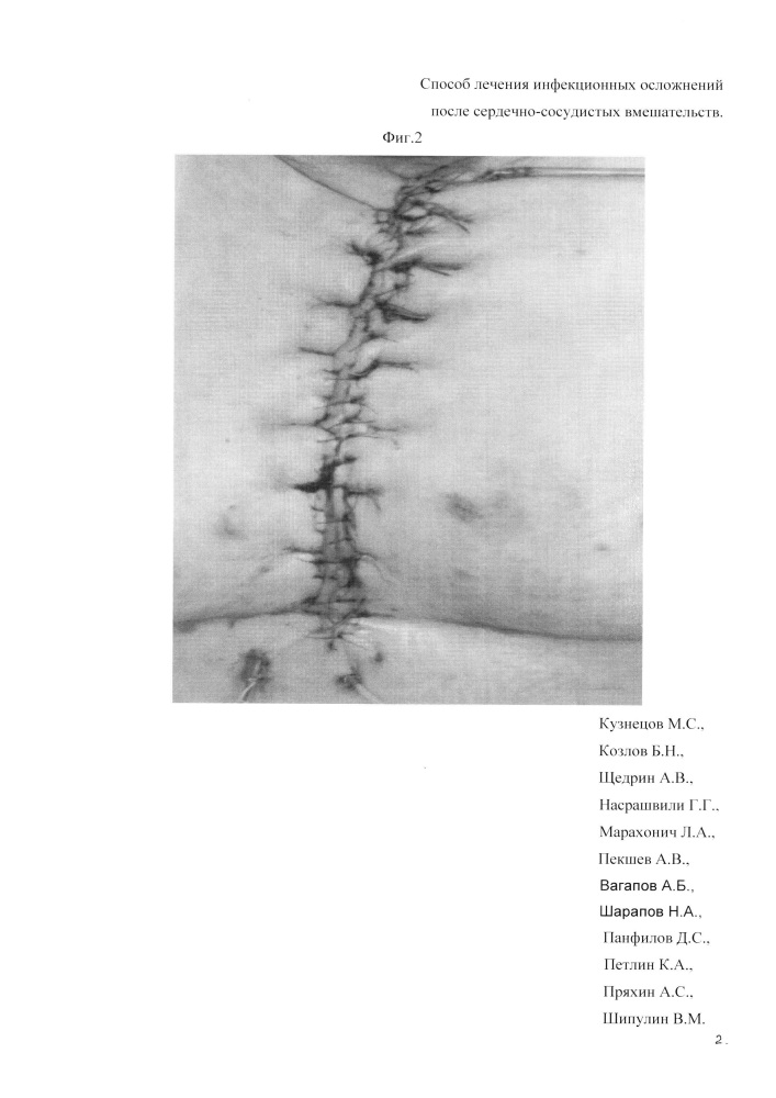 Способ лечения инфекционных осложнений после сердечно-сосудистых вмешательств (патент 2647624)