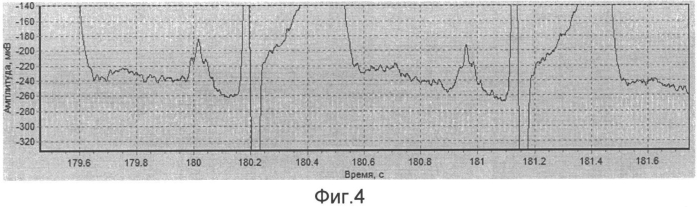 Электрокардиограф для неинвазивной регистрации микропотенциалов на электрокардиограмме в реальном масштабе времени (патент 2552876)