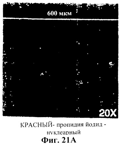 Захват эндотелиальных клеток-предшественников элюирующим лекарственные средства имплантируемым медицинским устройством (патент 2400256)