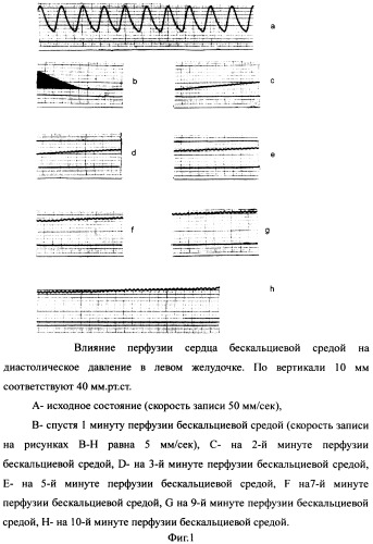 Способ измерения набухания кардиомиоцитов целого сердца при удалении са2+ из внеклеточной среды в эксперименте (патент 2368956)