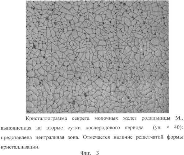 Способ прогнозирования ранней гипогалактии (патент 2563136)