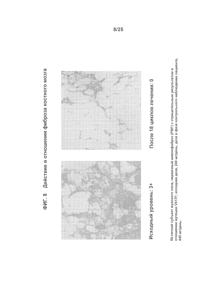 Композиции и способы лечения миелофиброза (патент 2616262)