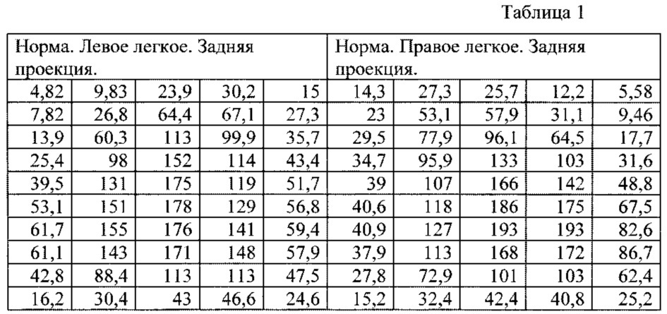 Способ количественного определения накопления радиофармпрепарата при радионуклидном исследовании перфузии легких (патент 2629044)