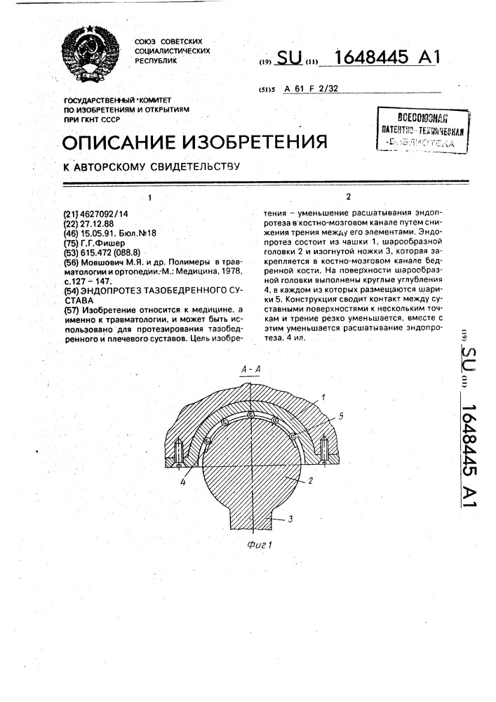 Эндопротез тазобедренного сустава (патент 1648445)