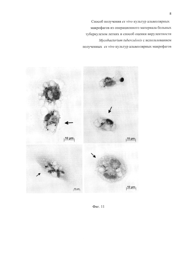 Способ получения ex vivo культур альвеолярных макрофагов из операционного материала больных туберкулезом легких и способ оценки вирулентности mycobacterium tuberculosis с использованием полученных ex vivo культур альвеолярных макрофагов (патент 2593725)