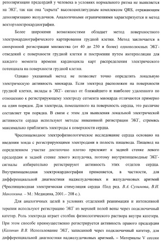 Способ неинвазивного электрофизиологического исследования сердца (патент 2417051)