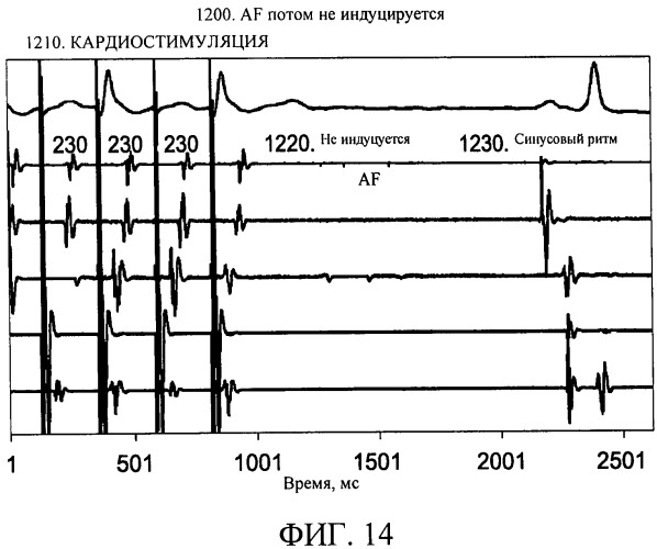 Способы, система и устройство для обнаружения, диагностики и лечения нарушений биологического ритма (патент 2559639)
