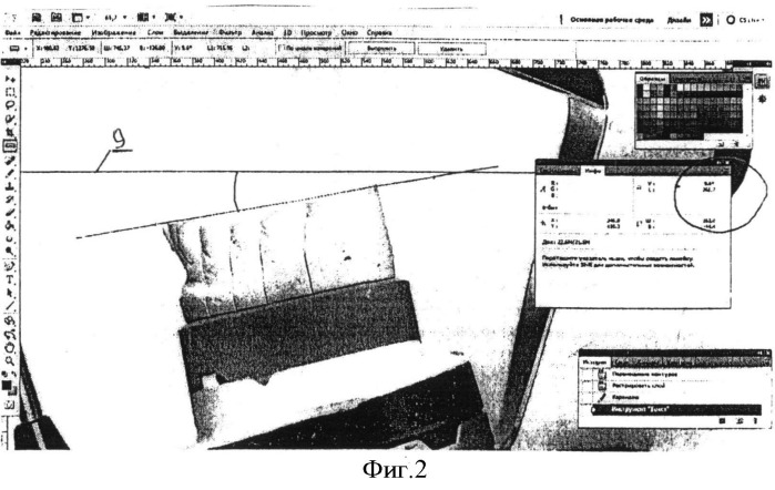 Способ контроля моделирования зубного ряда относительно скелетных ориентиров черепа пациента (патент 2504344)