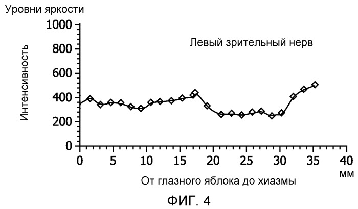 Классификация изображения на основе сегментации изображения (патент 2513905)
