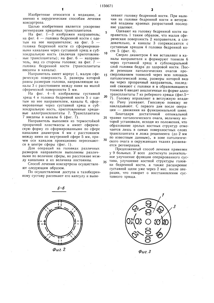 Способ лечения коксартроза (патент 1156671)