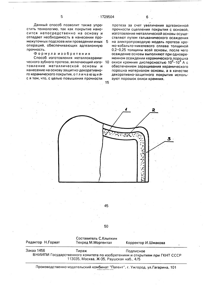 Способ изготовления металлокерамического зубного протеза (патент 1729504)