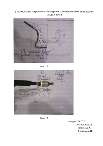 Универсальное устройство для измерения длины части уздечки языка у детей (патент 2584138)