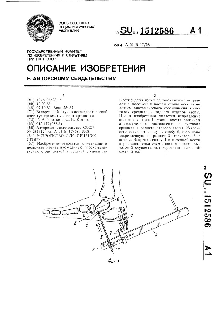 Устройство для лечения стопы (патент 1512586)