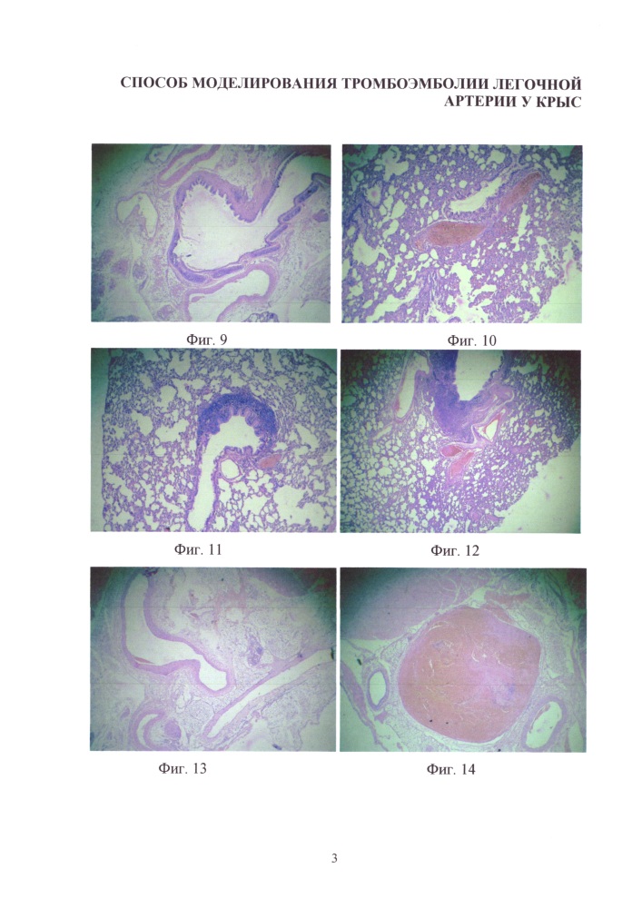 Способ моделирования тромбоэмболии легочной артерии у крыс (патент 2610212)