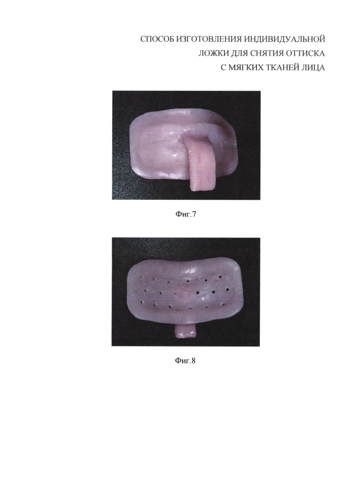 Способ изготовления индивидуальной ложки для снятия оттисков с мягких тканей лица (патент 2648848)