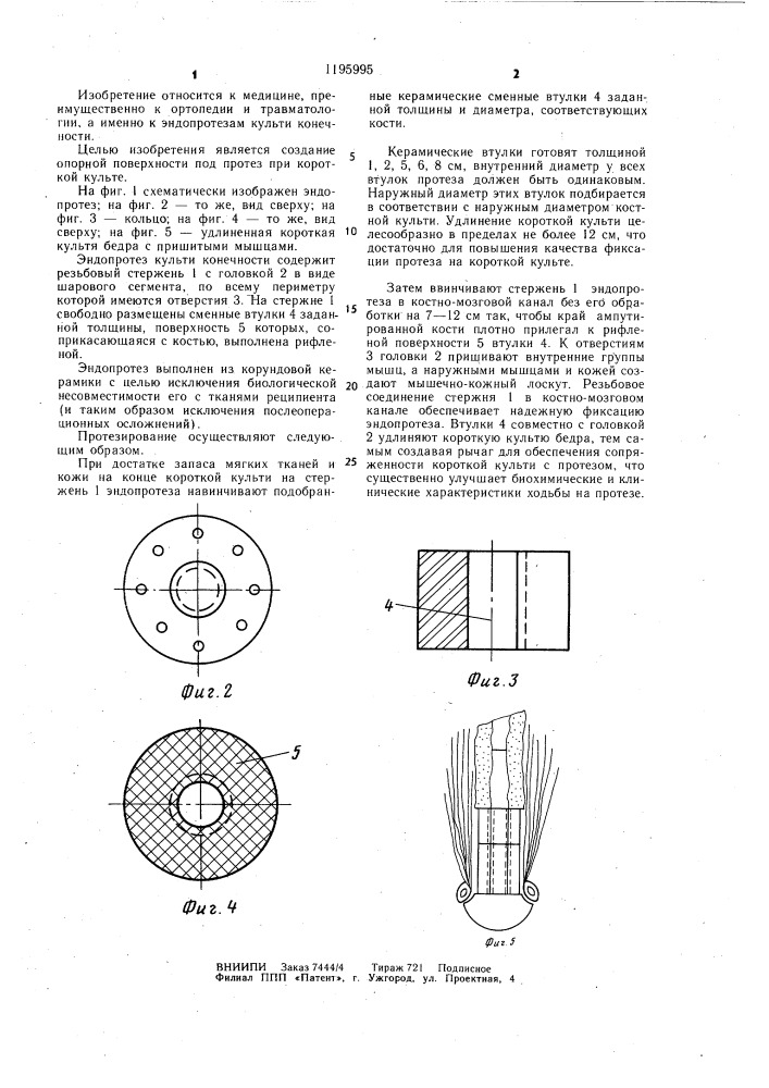 Эндопротез культи конечности (патент 1195995)