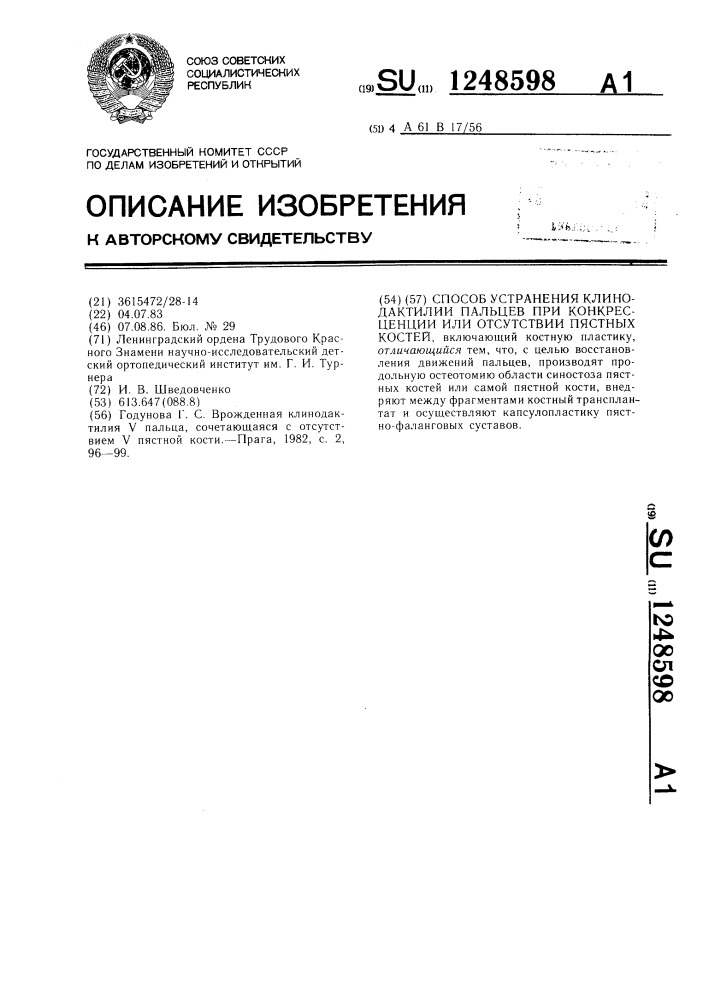 Способ устранения клинодактилии пальцев при конкресценции или отсутствии пястных костей (патент 1248598)