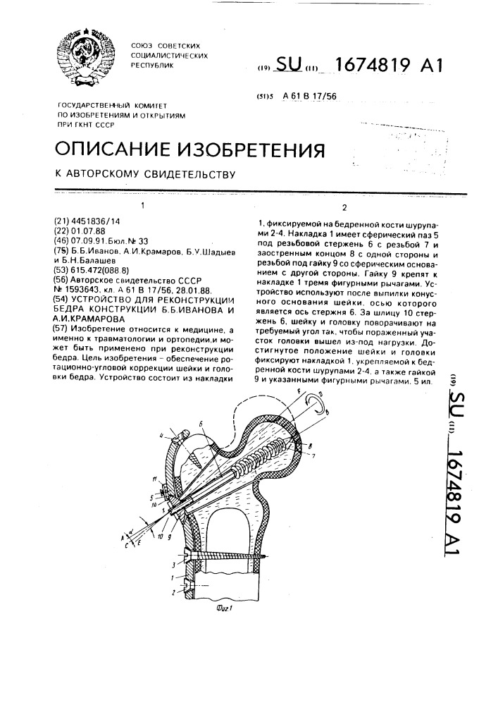 Устройство для реконструкции бедра конструкции б.б.иванова и а.и.крамарова (патент 1674819)