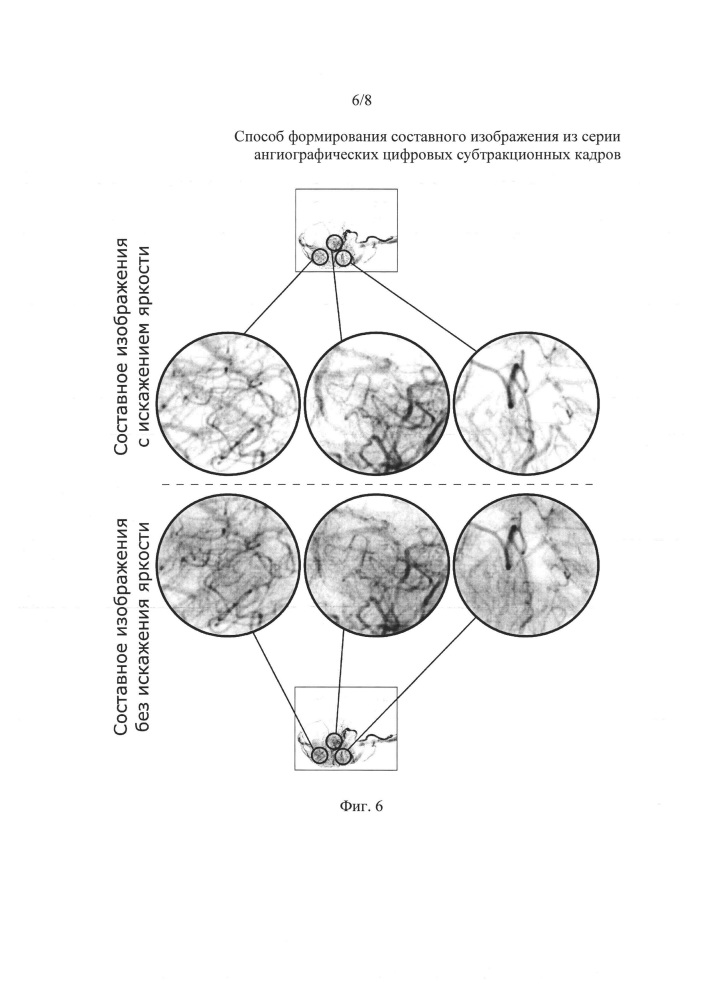 Способ формирования составного изображения из серии ангиографических цифровых субтракционных кадров (патент 2633949)