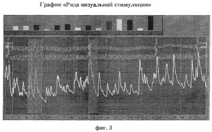 Способ диагностики нарушений сексуальных предпочтений (патент 2283029)