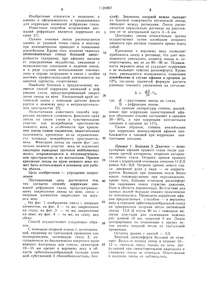Способ коррекции аномалий рефракции глаза (патент 1124967)