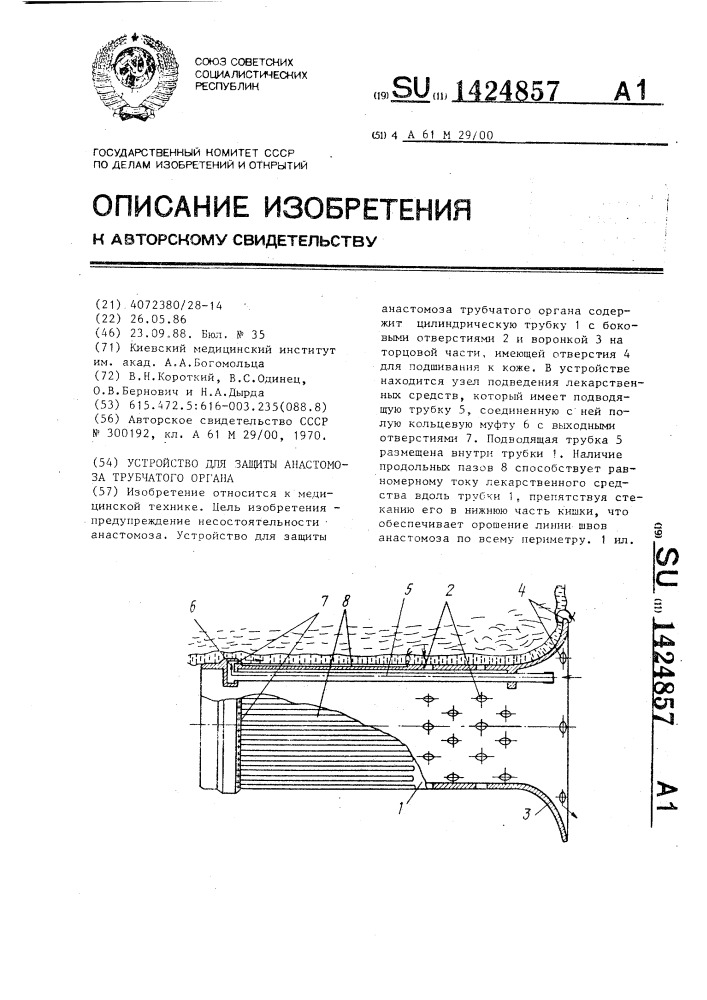 Устройство для защиты анастомоза трубчатого органа (патент 1424857)