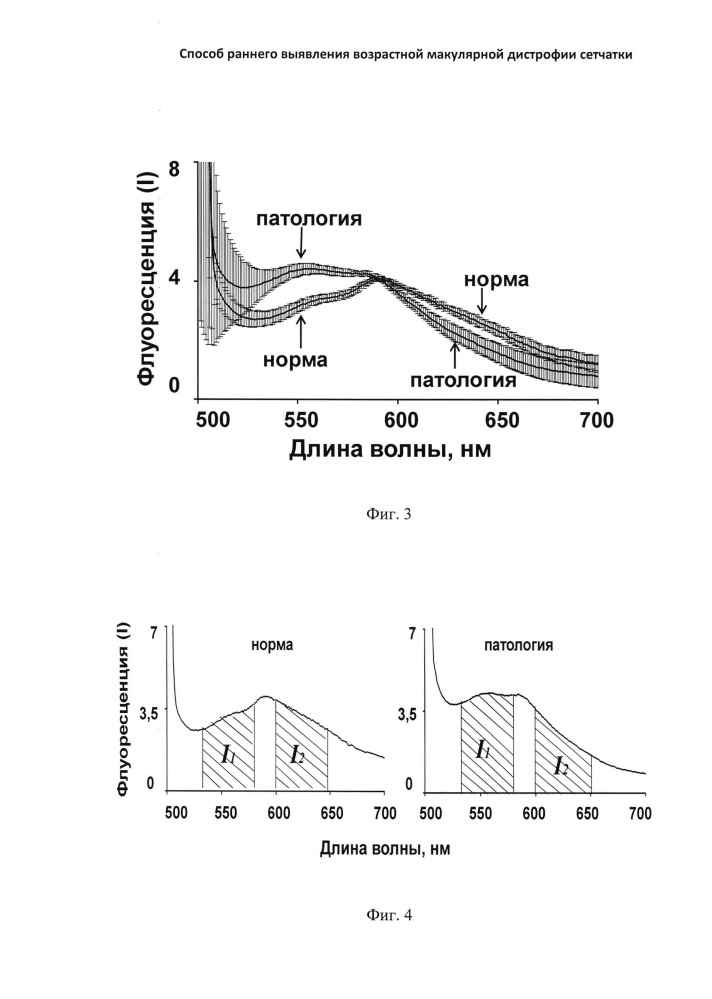 Способ раннего выявления возрастной макулярной дистрофии сетчатки (патент 2651126)