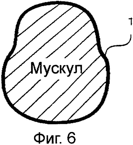 Устройство для укрепления мускулов (патент 2329846)