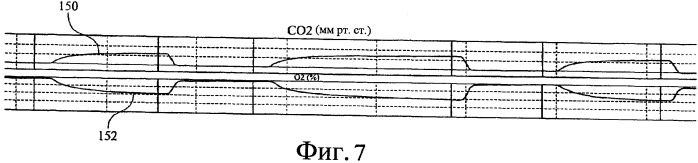 Система и способы определения качества сигнала и коррекции сигнала (патент 2471156)