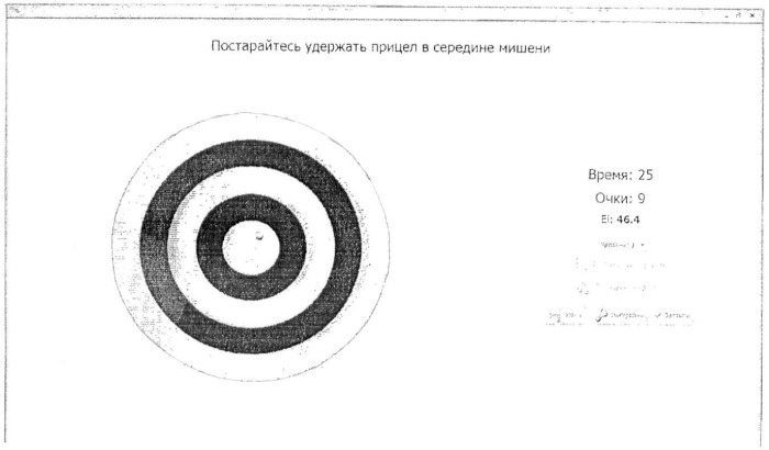 Способ стабилометрического исследования двигательной стратегии человека (патент 2456920)