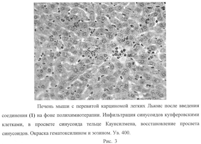 N-[3-оксо-лупано-28-ил]-морфолин - средство коррекции цитотоксических повреждений печени с противоопухолевой и антиметастатической активностью (патент 2461563)