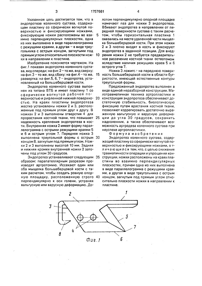 Эндопротез коленного сустава (патент 1757661)