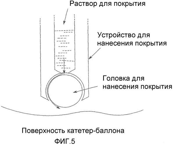 Медицинский продукт для лечения обтураций просветов организма и для предупреждения угрожающих повторных обтураций (патент 2458710)