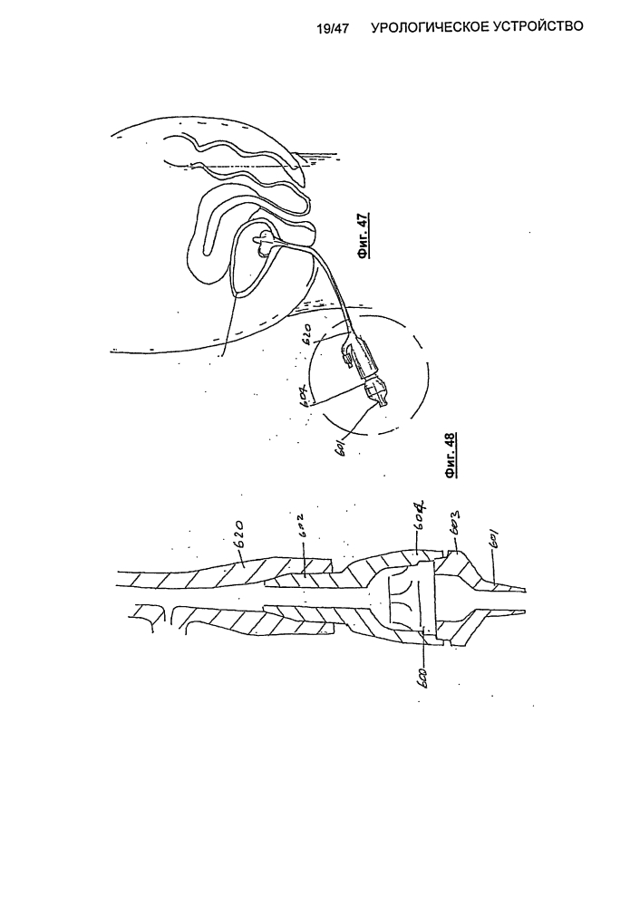 Урологическое устройство (патент 2600865)