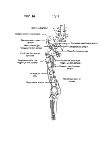 Ангиосомная система контроля кровоснабжения (патент 2587949)