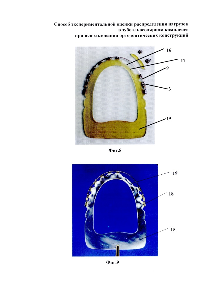 Способ экспериментальной оценки распределения нагрузок в зубоальвеолярном комплексе при использовании ортодонтических конструкций (патент 2618888)