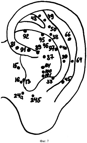 Способ определения функционального состояния больных по порогу чувствительности точек акупунктуры на ушной раковине (патент 2303395)