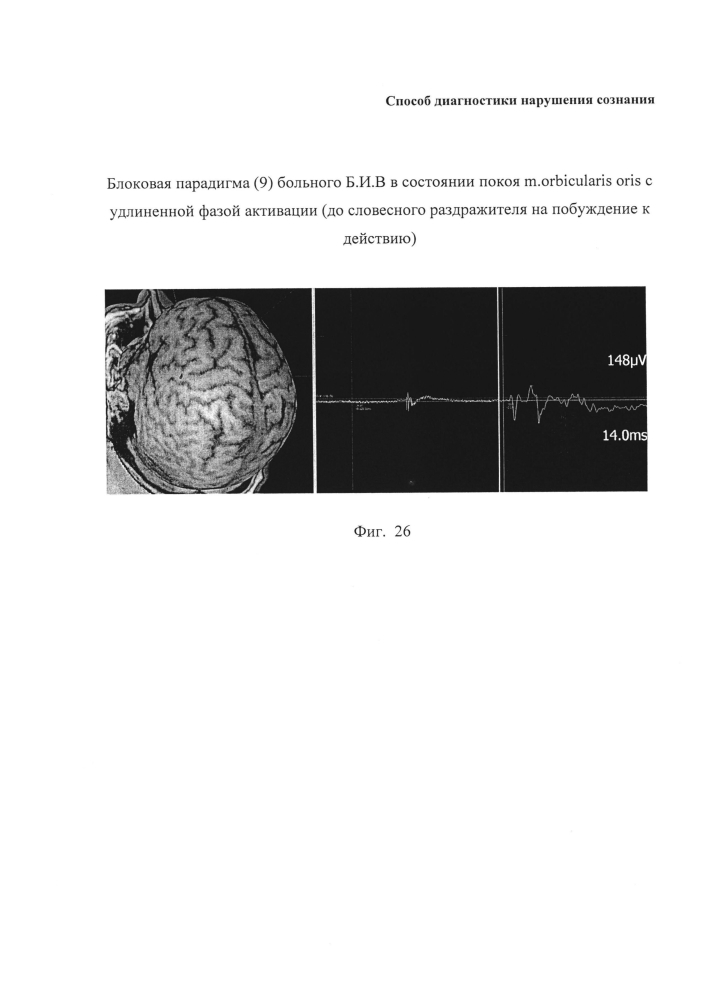 Способ диагностики нарушения сознания (патент 2596049)