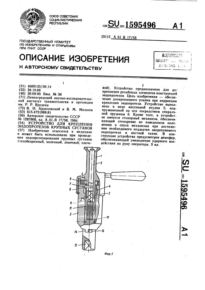 Устройство для крепления эндопротезов крупных суставов (патент 1595496)