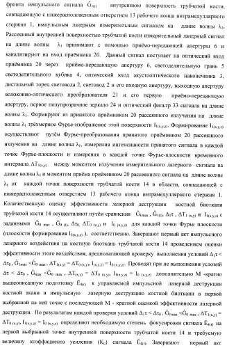 Способ дистального блокирования интрамедуллярных стержней при остеосинтезе длинных трубчатых костей и устройство для его осуществления (патент 2387401)