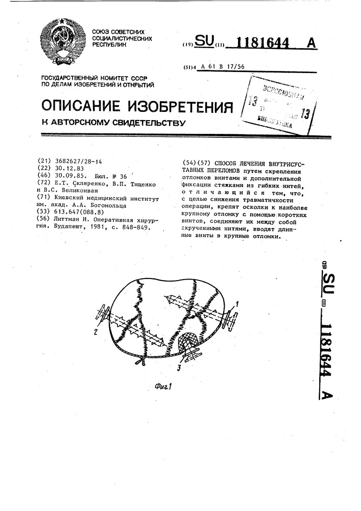 Способ лечения внутрисуставных переломов (патент 1181644)