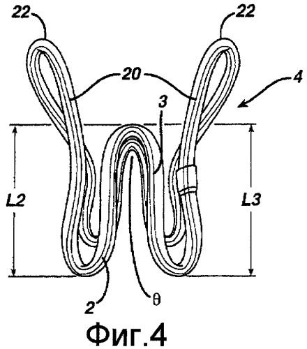 Упругое устройство (патент 2432927)