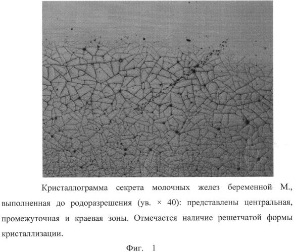 Способ прогнозирования ранней гипогалактии (патент 2563136)